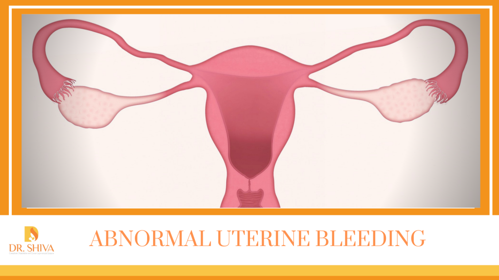 Ppt What Is Abnormal Uterine Bleeding Powerpoint Presentation Free Hot Sex Picture