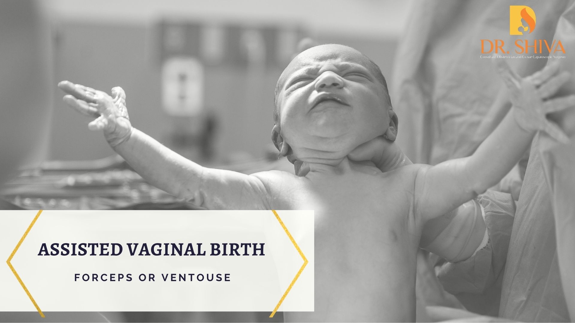 Assisted vaginal birth – Forceps or Ventouse