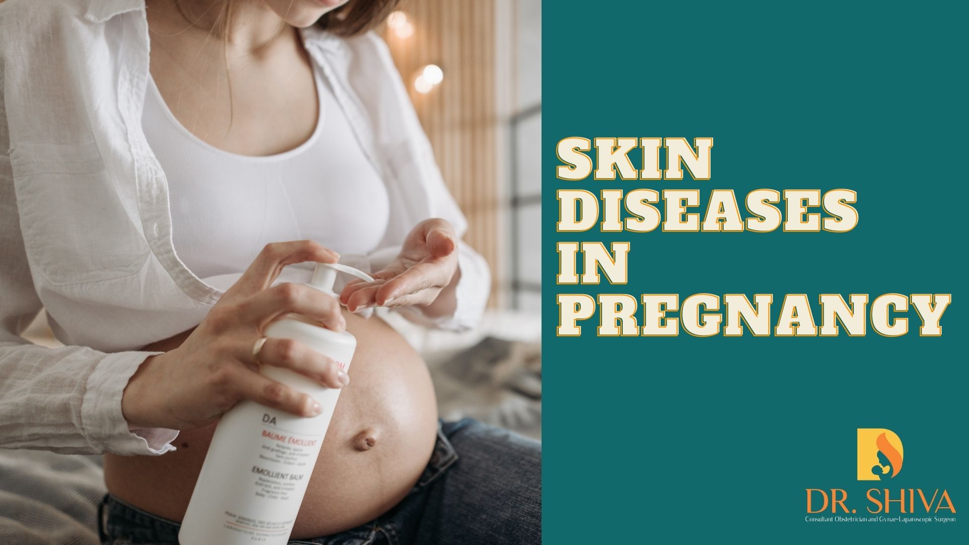 Skin diseases in pregnancy