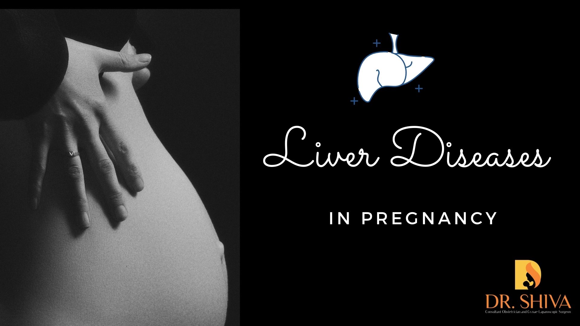 Liver diseases in pregnancy