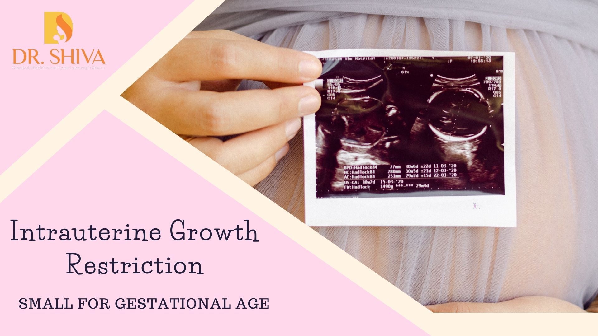 Intrauterine growth restriction/Babies small for dates