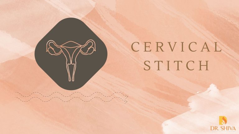 Cervical Stitch/Cervical Cerclage | Pregnancy Complications
