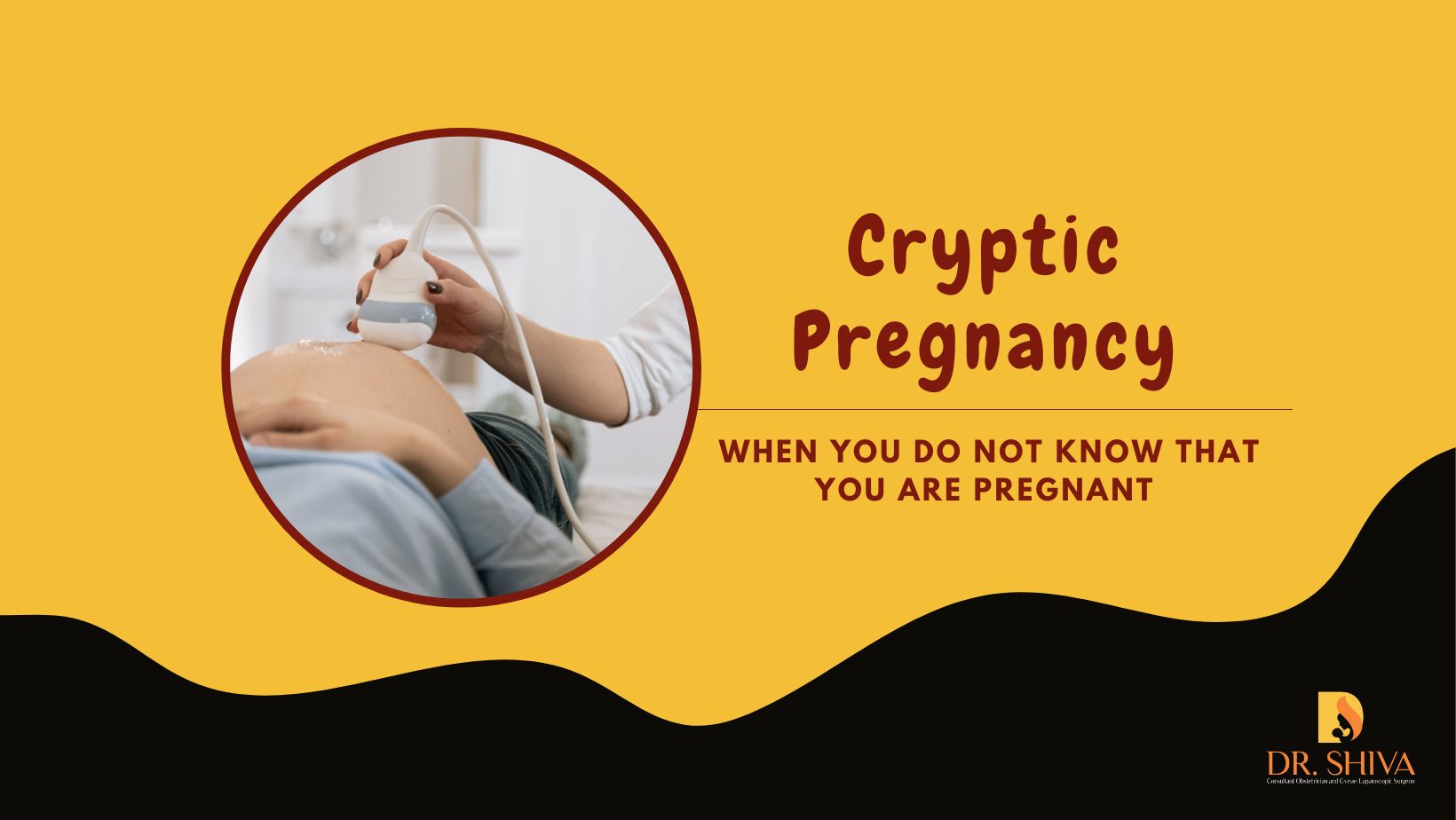 Cryptic pregnancy