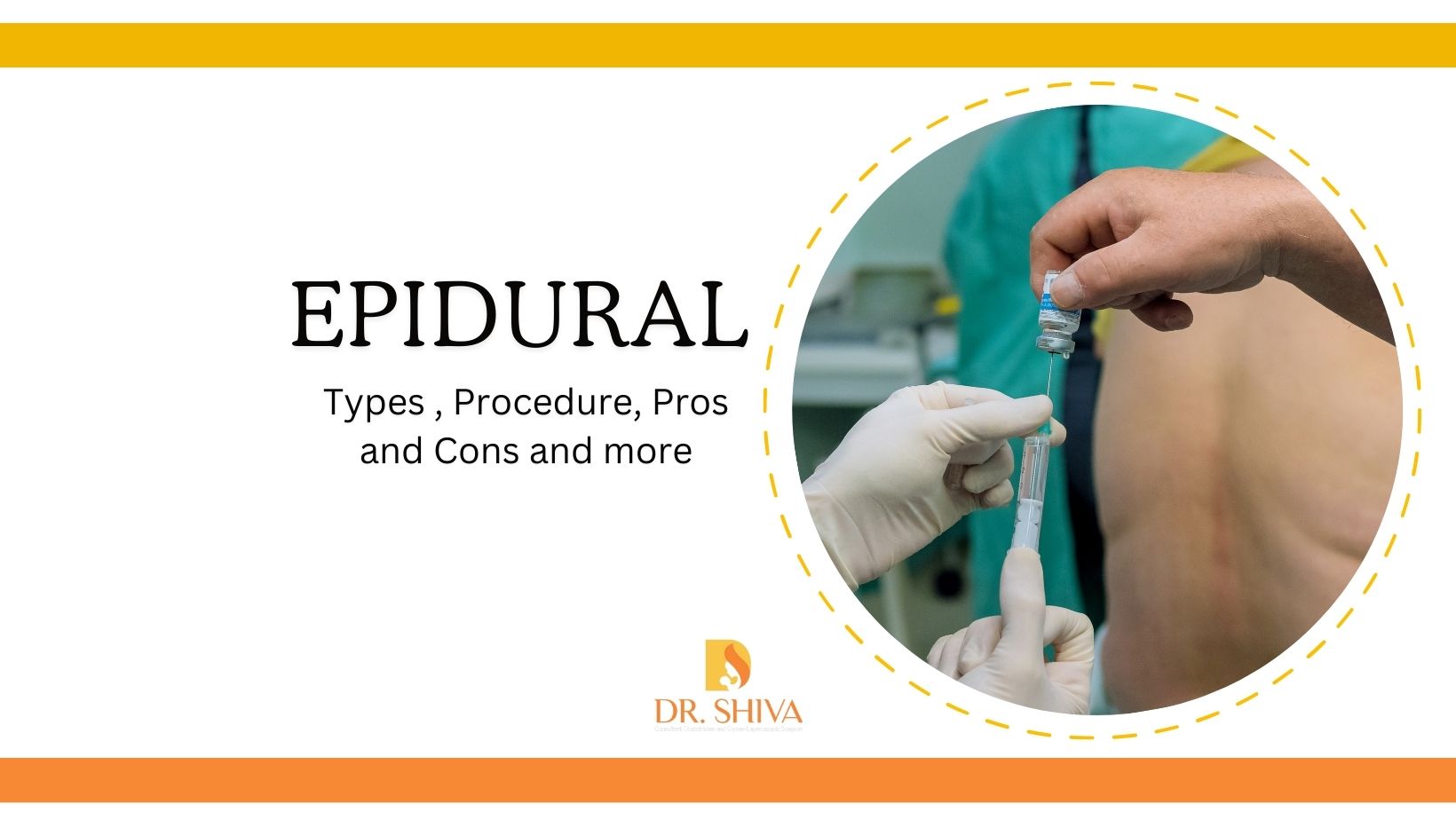 Epidural procedure